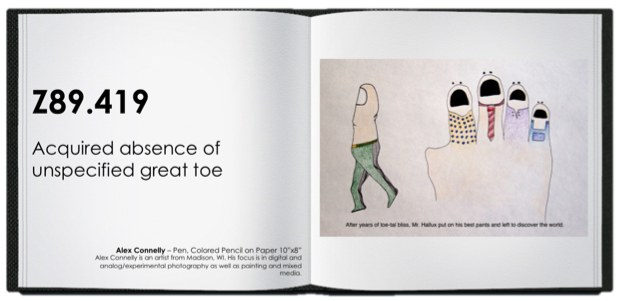 Struck by Orca: ICD-10 Illustrated